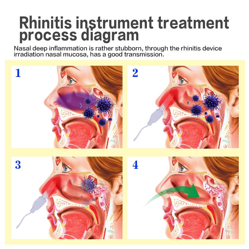 Dispositivo a Laser para Tratamento Rinite e Sinusite - Bionase